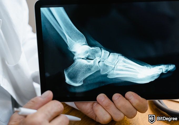 Online Healthcare Degrees: doctor showing x-ray of a foot.