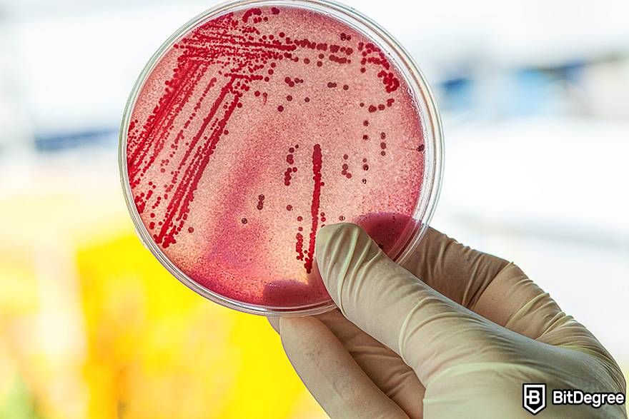 Online chemistry courses: a scientist is holding a petri dish with bacteria.